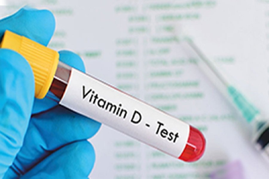 Why Do You Need To Know Your Vitamin D Levels